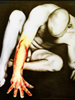 Red Arm